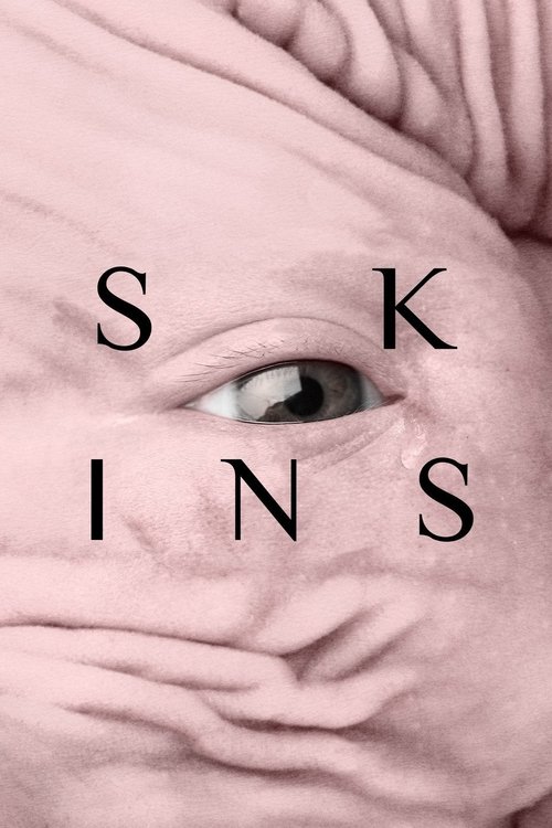 Pieles (Skins)