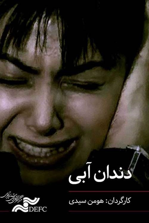 دندان آبی (Blue Tooth)